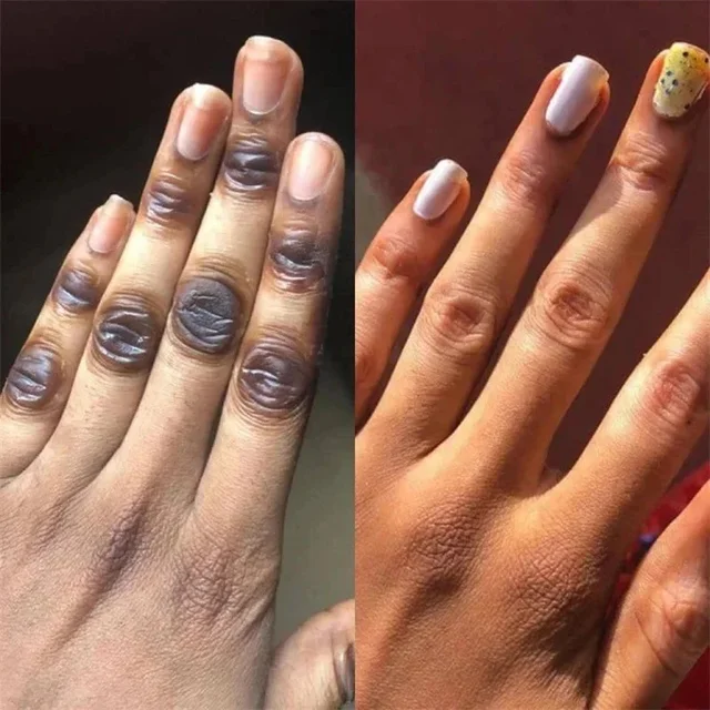 Fast Whitening Dark Knuckles Brighten Hand Cream Melanin Corrector Moisturizing Intense Stains Remover Products Skin Care 3