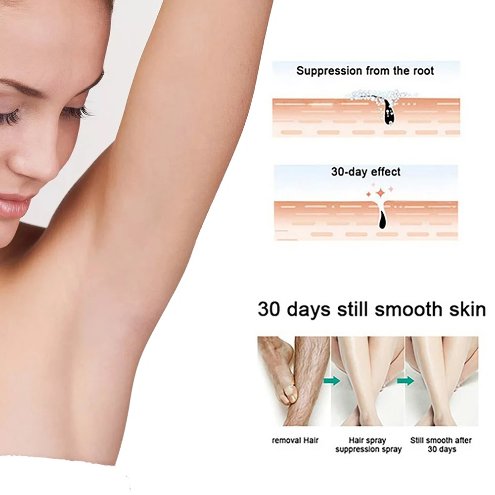30/50 ml Leistungsstarkes Haarentfernungsspray – Super natürliche, schmerzfreie und dauerhafte Haarentfernung für Frauen und Männer – Ganzkörper-Enthaarungscreme_voghion.com