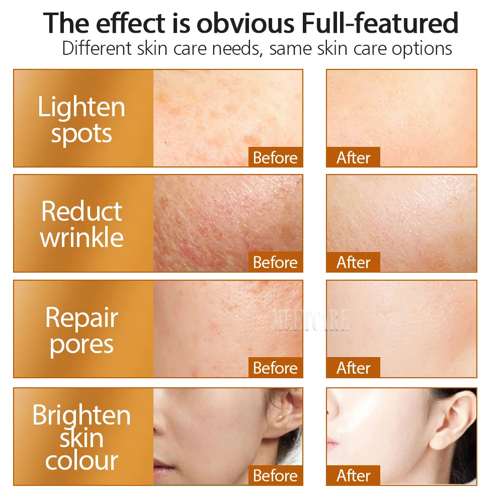 derma roller 192pin Derma Roller Microneedle Dermaroller Tips Mesotherapy Face Care Hair-loss Scar Stretch Mark Removal