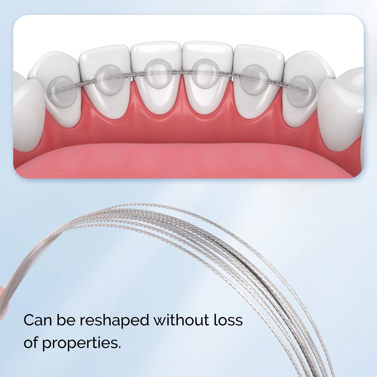 ワイヤー歯科矯正　TP Orthodontics TP オリジナルワイヤー | ティーピー・オーソドンテックス・ジャパン