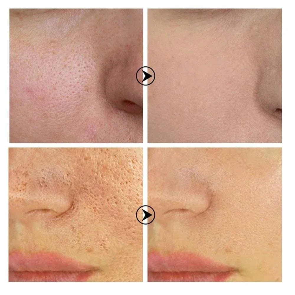 Skin Texture | Pore Refining Resurfacing, Brightening Facial Serum with Retinol and Niacinamide Non-Comedogenic 6