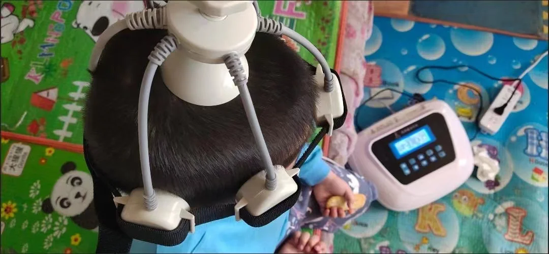 Transcranial Magnetic Stimulator
