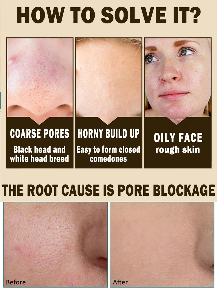 Effective Pores Remover Pore Shrinking Serum Shrink Tightening Minimizing Serum Facial Skin Care Products Acne Treatment