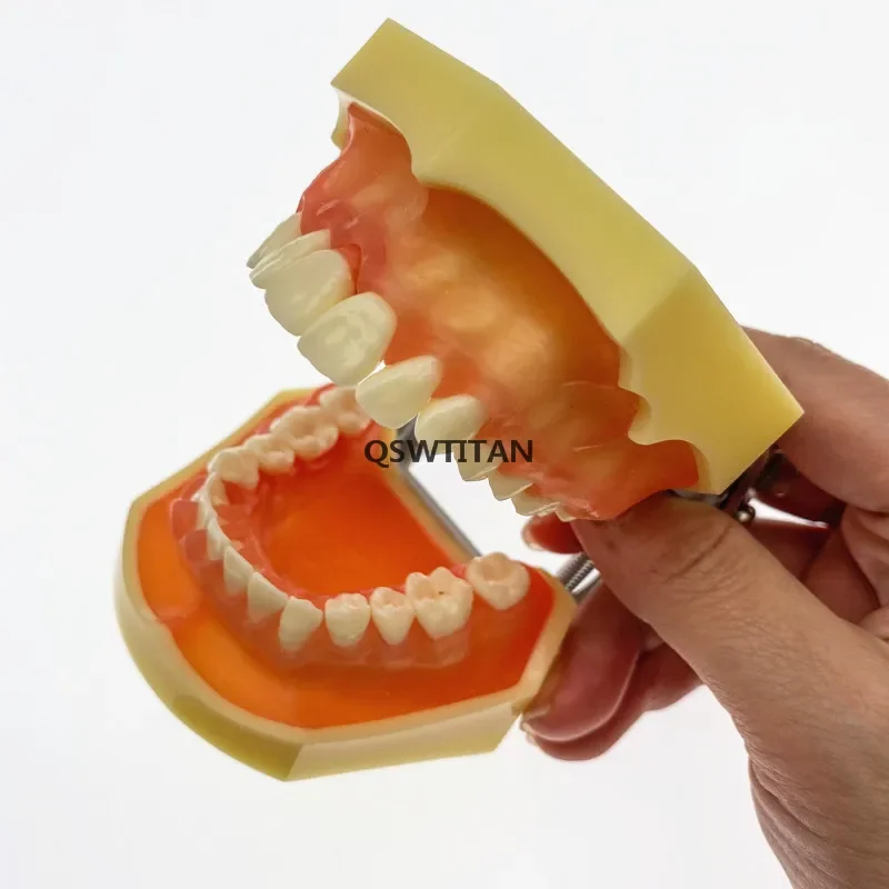 Dental Model M4017 – Adult Pathological Periodontal Disease Study Teaching Teeth