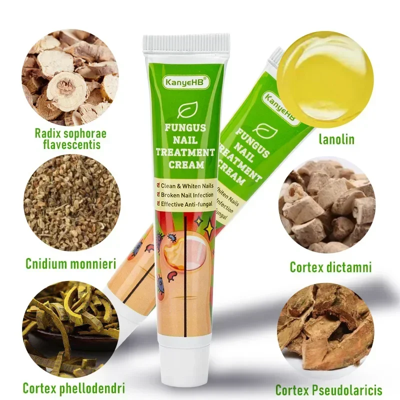 Nail Fungus Treatment Cream Onychomycosis Paronychia Anti Fungal Nail Infection Fights Bacteria and Fungus Naturally Oint U&ntilde;as nail fungus remover