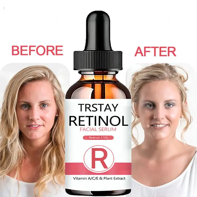 Retinol-Powered Skin Renewal for Radiant, Youthful Skin