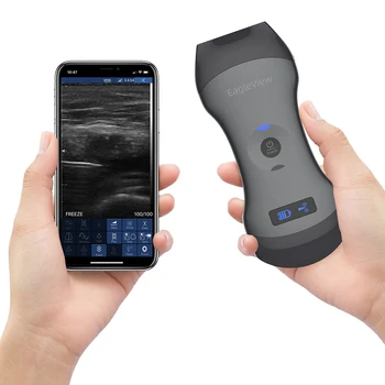 Wireless Handheld Ultrasound Scanner for Full-body Diagnostic