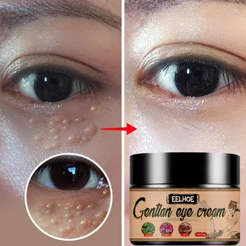 Fat Granules Remover Eye Cream Remove Dark Circles Eye Bags Fade Fine Lines Anti-Puffiness Wrinkles Lift Firming Eye Skin Care - Thumbnail 2