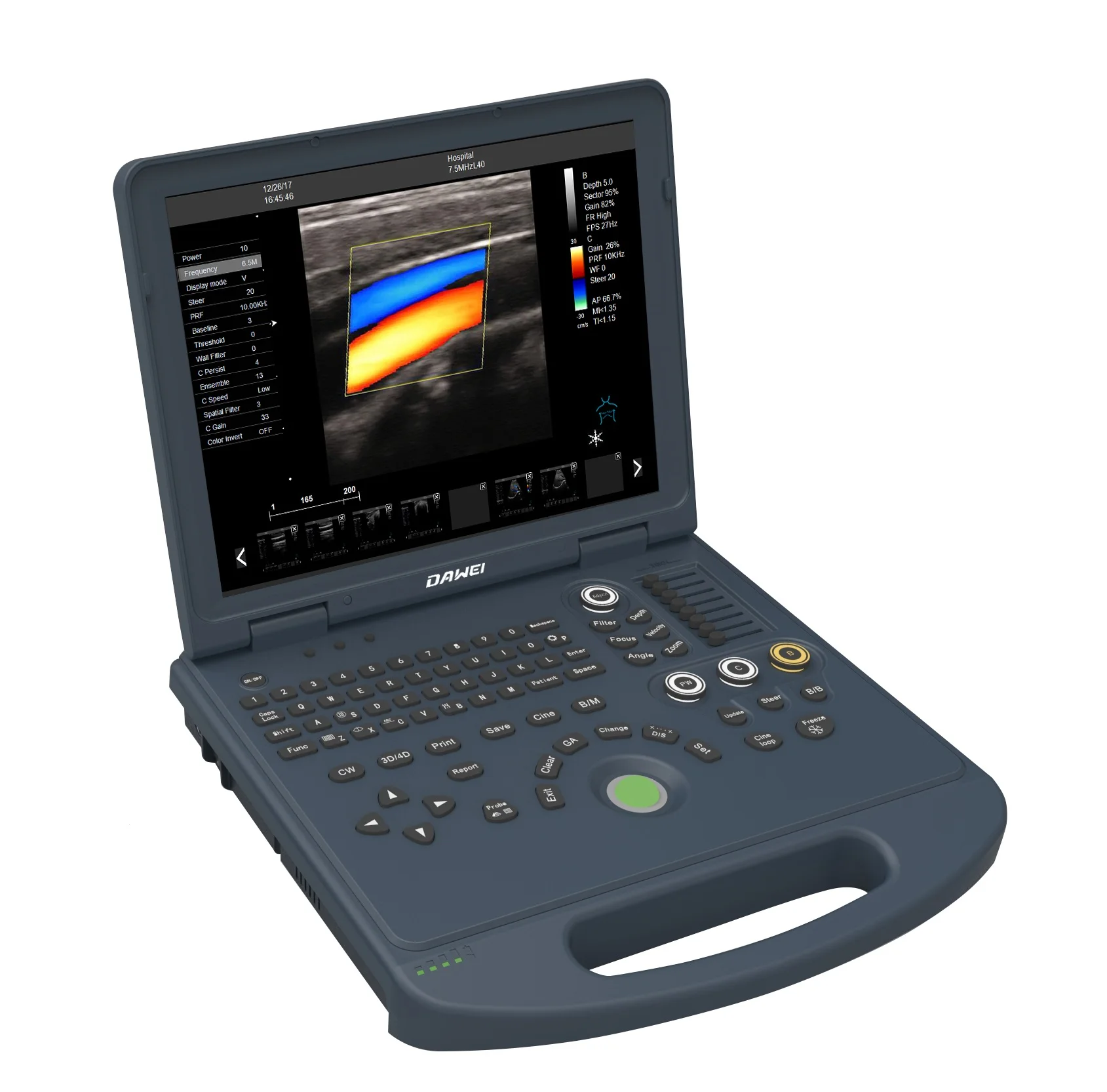 Ecografo Portatil Ultrasound 15 Led Laptop Portatile Color Doppler Ultrasound