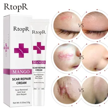Skin Scar Removal Cream Face Fade Scars Cream Acne Spots Acne Treatment Blackhead Whitening Cream Anti Scar Stretch Marks Beauty 3