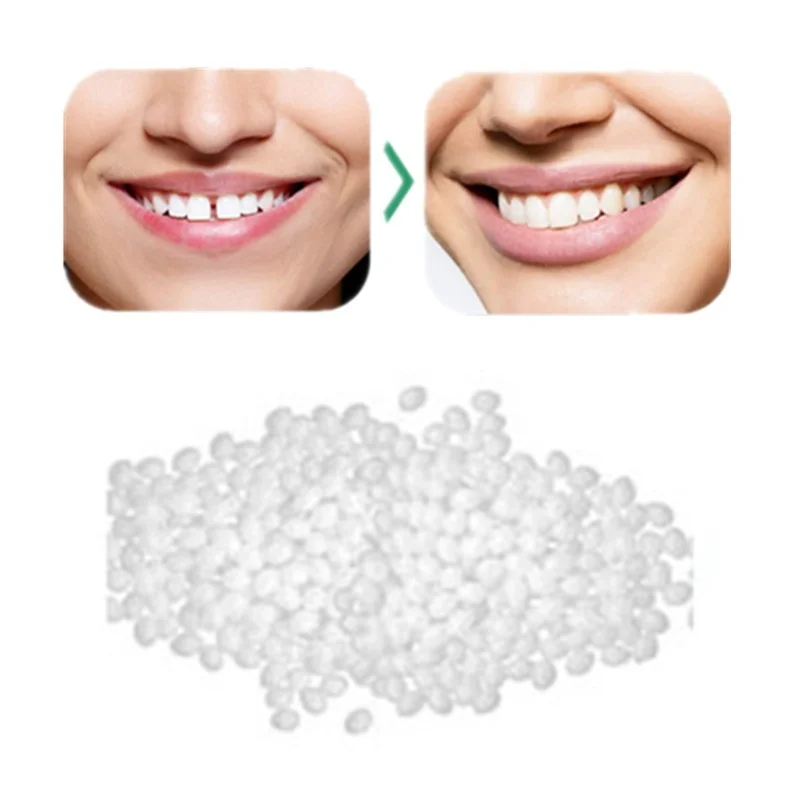 Fashion Temporary Tooth Replacement Material Tooth Filling Temp Replace Missing Denture Adhesive