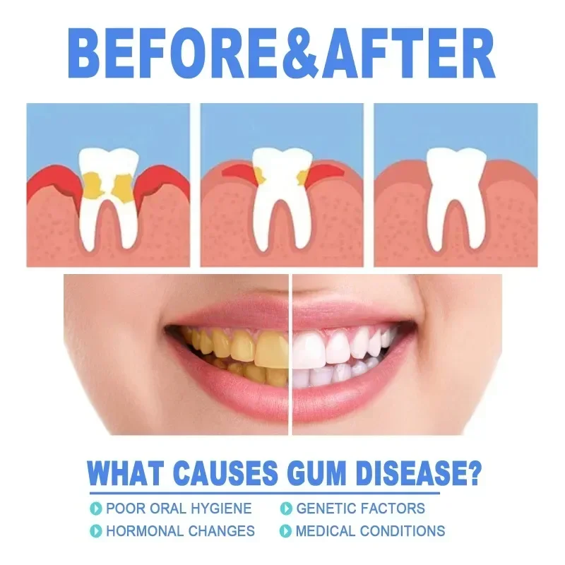 Tooth Repair Toothpaste Gel relief gum swelling pain cleaning yellow stains tartar removal odor Breath teeth Pen Oral Care teeth whitening product,teeth whitening essence,dental calculus remover,teeth health product