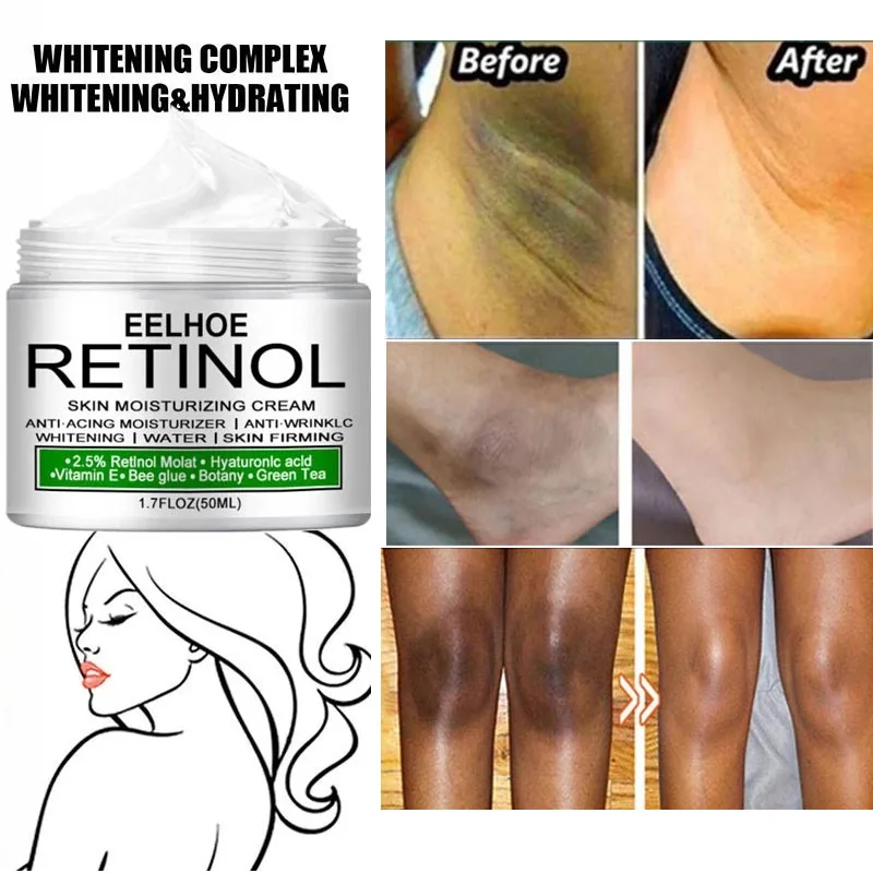 Körperaufhellungscreme, Achseln, Knie, Gesäß, dunkle Haut, Bleichmittel, verbessert die Melaninpigmentierung, stumpf, feuchtigkeitsspendend, erhellt die Hautpflege_voghion.com