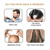 Anti Hair Loss Shampoo Fast Growing Repair Damaged Scalp Dry Frizzy Treatment Deep Nourishment Moisturizing Regrowth Conditioner 4