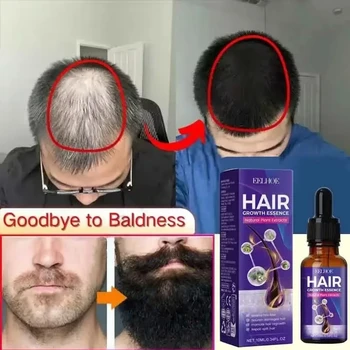 La crescita dei capelli Trattamento essenziale per la ricrescita della perdita Rafforza i capelli Nutre il cuoio capelluto Leggero Non grasso Migliora la circolazione del cuoio capelluto