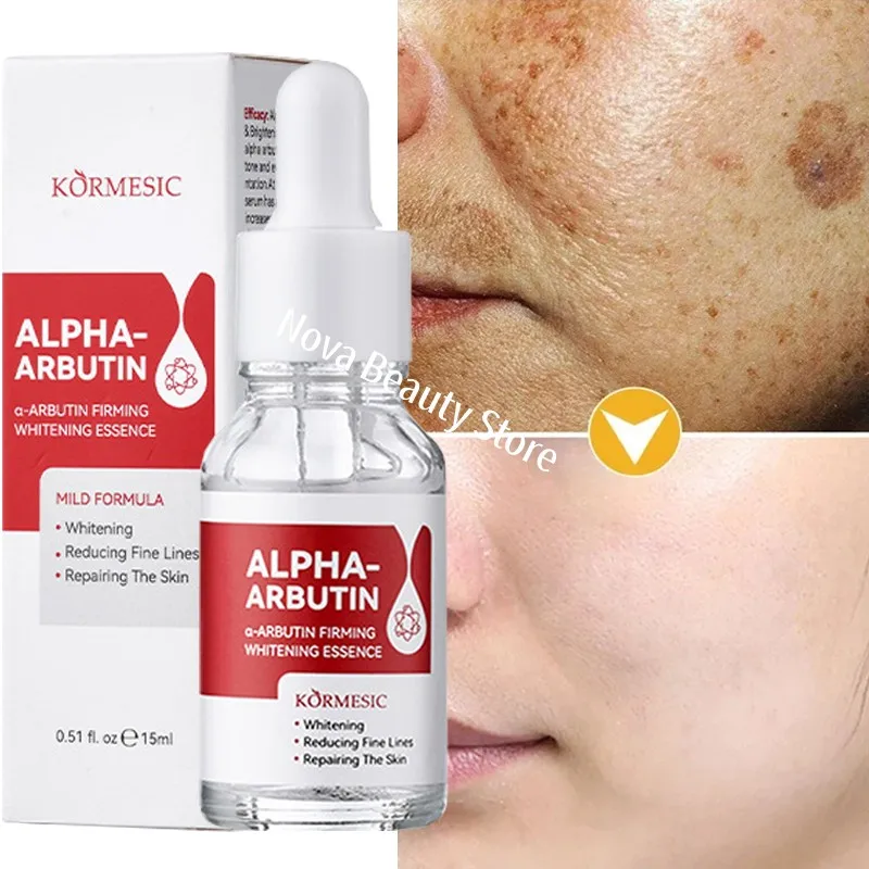 Dark Spots Remover Whitening Serum Face Freckle Melanin Correcting Reduce Fine Lines Brighten Essence Korean Beauty Skin Care 1