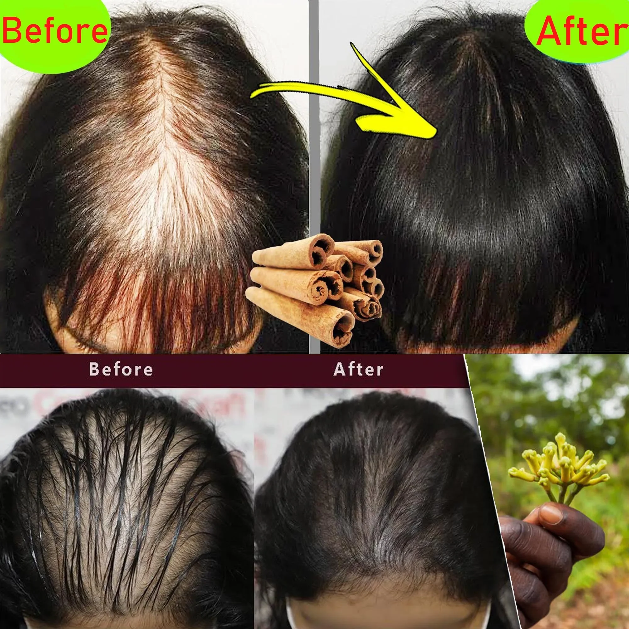 Africa Crazy Hair Edges Growth Traction Alopecia Chebe Powder Thicken Grow Long Hair Shampoo Hair Loss Treatment Wildly Beauty 4