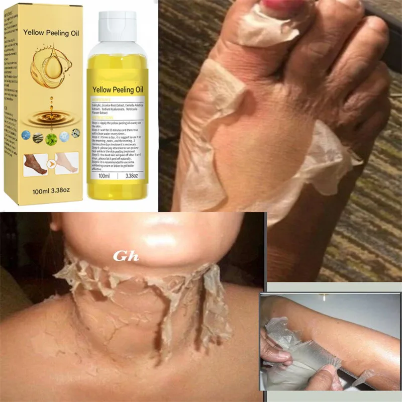 

100 мл желтое пилинг масло для тела Отшелушивание сильное осветление локтей коленей рук выравнивание тона кожи и отбеливание кожи