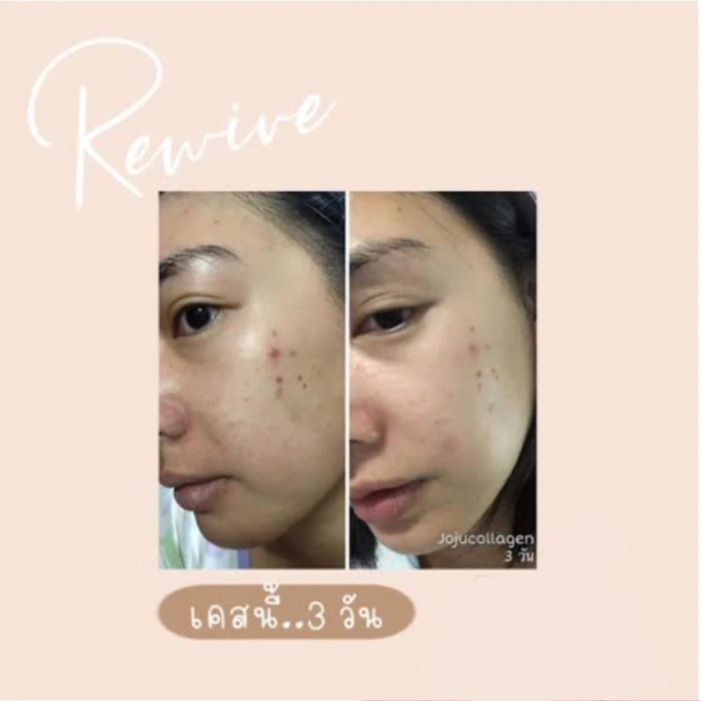 3X JOJU Collagen Dipeptide Reduce Acne Dark Spots Freckles oil control Smooth Lightening Whiten and brighten Younger Skin Care