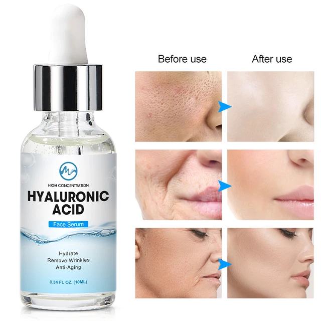 Minch Hialuronsav Hidratáló Szérum Zsugorodó Pórusok Olajkontroll Essence Whitening Brighten Ránc Eltávolító 50 Ml - Image 3