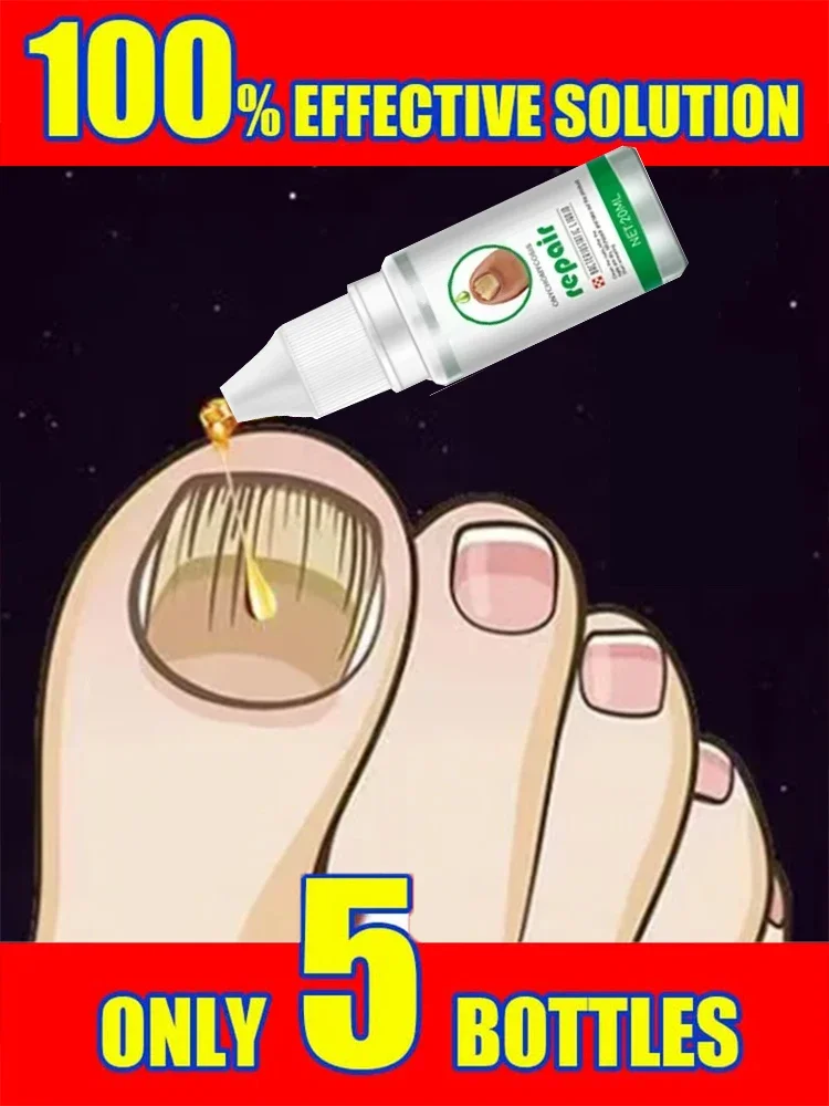 Extra Nail Fungus Treatment Serum Essence oil Feet Nails Repair Care Essence Cream Anti Infection Toe Fungal Removal