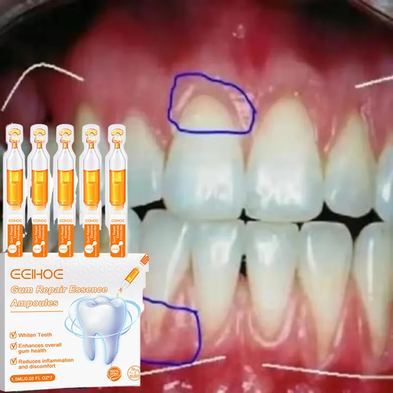 Gum Repair Drops Gum Repair Serum Drops Relieve Receding Gum Periodontal Yellow Treatment Pharyngitis Oral Pain Cleaning Antibacteria Teeth Care