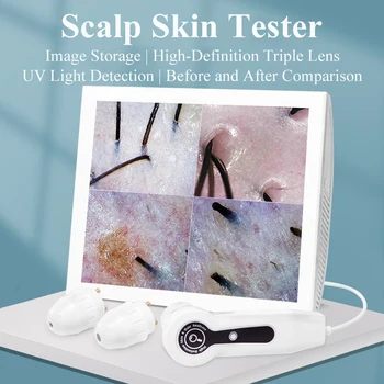 Analizzatore Professionale del Cuoio Capelluto con Display HD da 15 Pollici, Ingrandimento 50/200X, Macchina Diagnostica per Follicoli Piliferi, Tester per Olio e Idratazione della Pelle