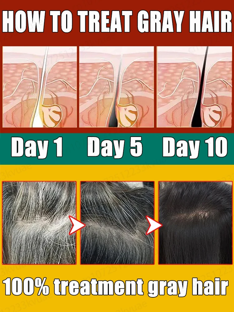Gray Hair Killer the perfect solution to gray hair problems and restore natural hair color hair color restorer
