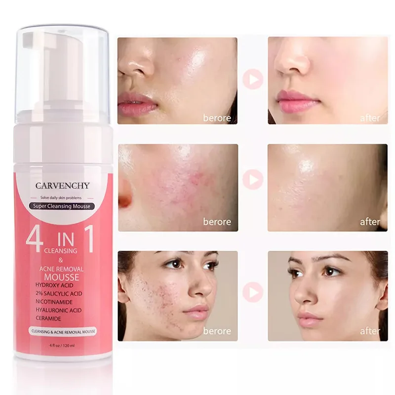 Ser facial antirid 4 în 1, albire, îndepărtează petele întunecate, micșorează porii, hidratant anti-îmbătrânire, hrănește îngrijirea pielii coreeană_voghion.com