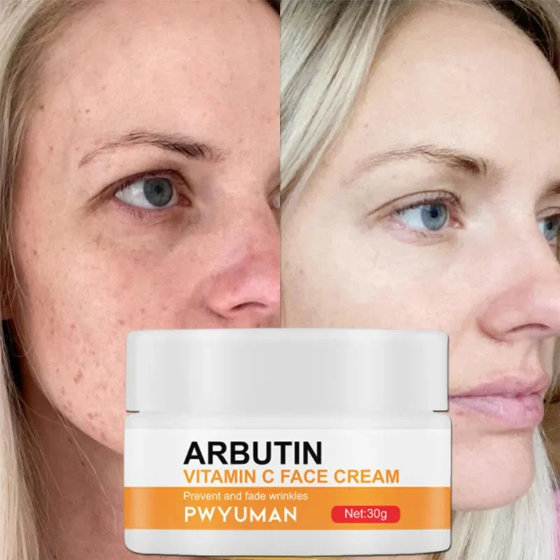 

Vitamin C Whitening Freckle Facial Cream Remove Dark Spot Fade Melasma Melanin Firm Anti-Aging Brighten Moisturizing Skin Care