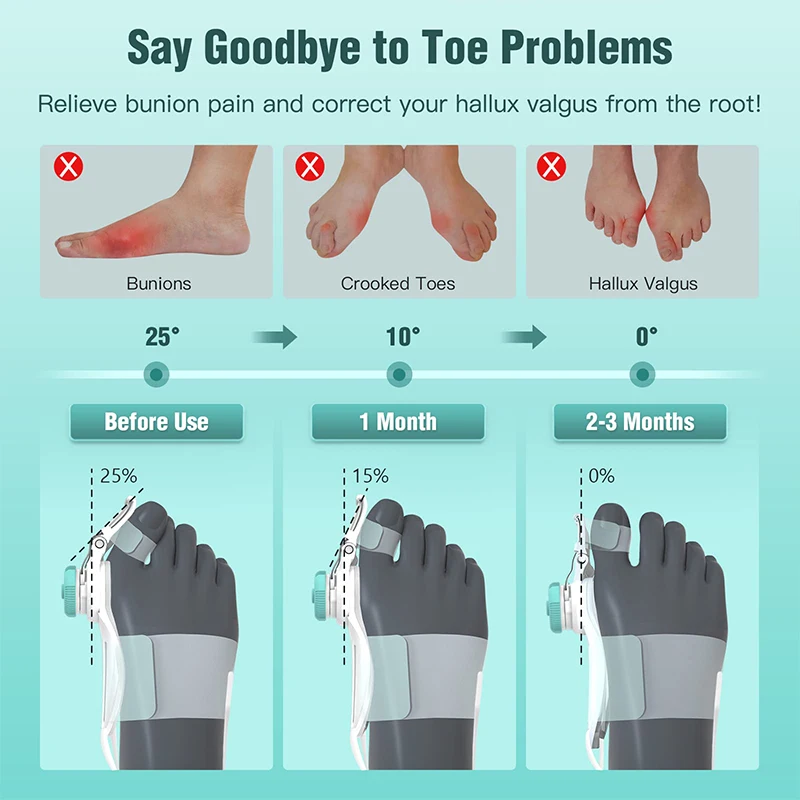 Bunion Corrector Thumb Valgus Toe Orthosis Foot Thumb Valgus Corrector Foot Soft Silicone Improves Large Foot Bones 2