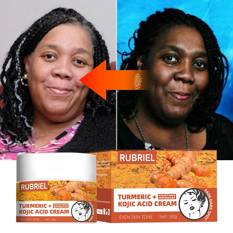 Crmeclaircissantelacidedecurcumakojiquesoinsduvisageclaircir