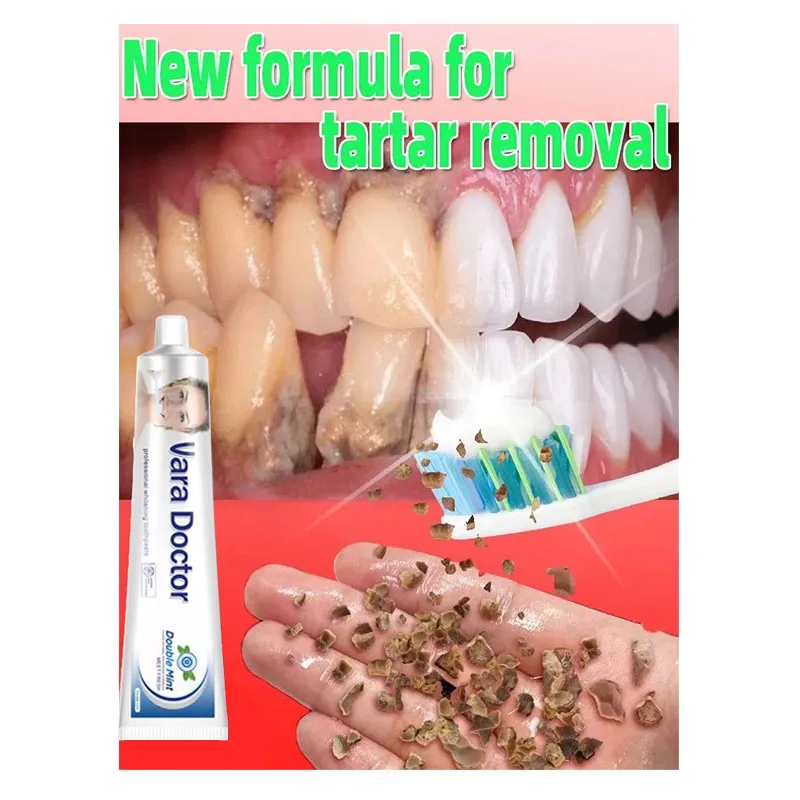 Dental Calculus Remover Toothpaste Wipe Off Plaque Stain Herbal Fresh Breath Teeth Whitening 100g