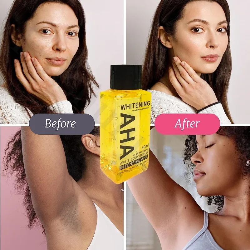 Whitening Body Serum Bleaching Brightening Skin,AHA,Vitamin B,C 30 Ml Bleaching Dark Spot Serum 4
