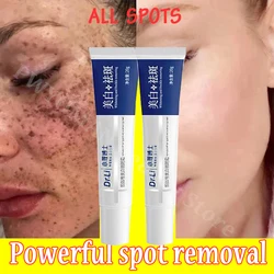 Nicotinamide Whitening Cream Lighten Freckles Melasma Treatment Pigmentation Ointment Dark Spot Remove Brighten Korean Skin Care