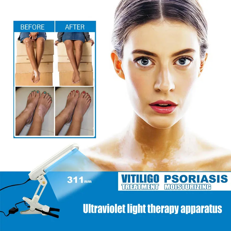 GLENN 311nm Uvb Phototherapy Narrow Uv Phototherapy Light Uvb Lamp Therapy Psoriasis For Vitiligo special narrow head double pin leg belt buckle super light comfortable 120 cm length