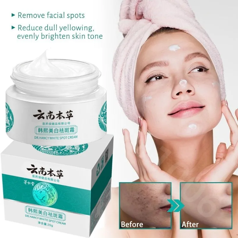 

Whitening Freckles Cream Remove Melasma Dark Spot Lightening Melasma Moisturize Brighten Removal Face Remover Care Skin Mel