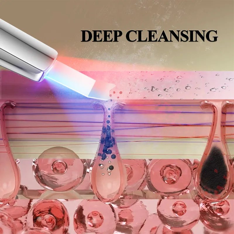 Skin Scraper Beauty Device Ultrasonic Blackhead Removal Beauty Device Pore Cleaner High-quality Power Waterproof Sweat Proof