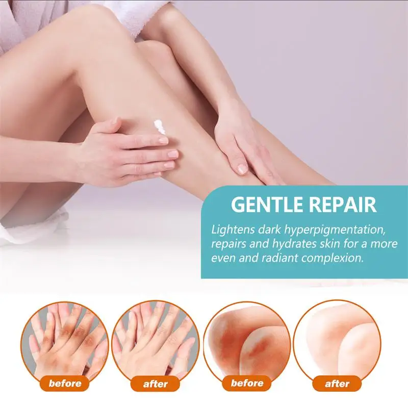 Brighten Cream Bleaching Armpits Elbows Knees Moisturizing Body Lotion Cream Brightening Lightening Melanin Skin Cream 3
