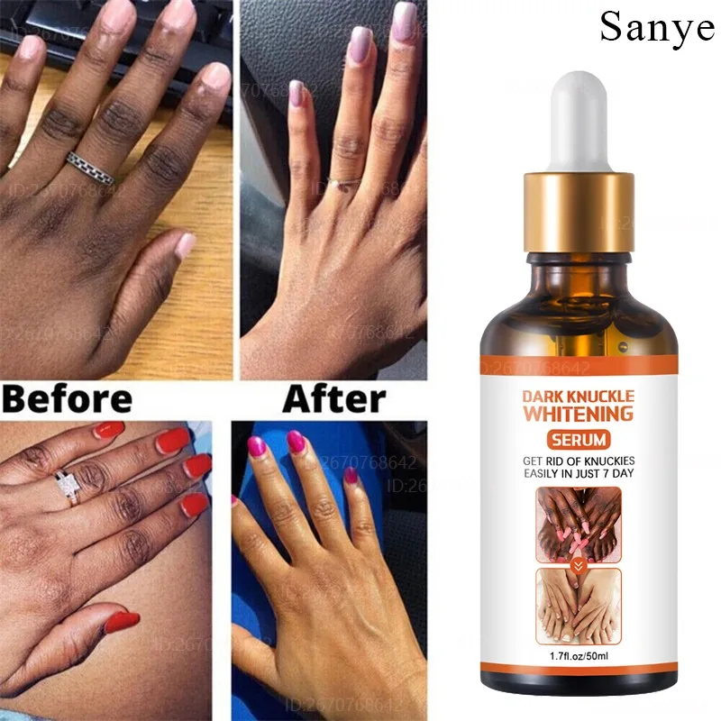 Powerful Removal Dark Melanin Essence for Women Finger Joints Whitening Serum Knees Armpits Skin Moisturizing Brightening Care