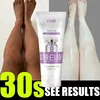 Body Whitening Cream Private Parts Underarm Legs Knee Bleach Lotion Inner Thigh Intimate Dark Remove Melanin Brighten Skin Care 1