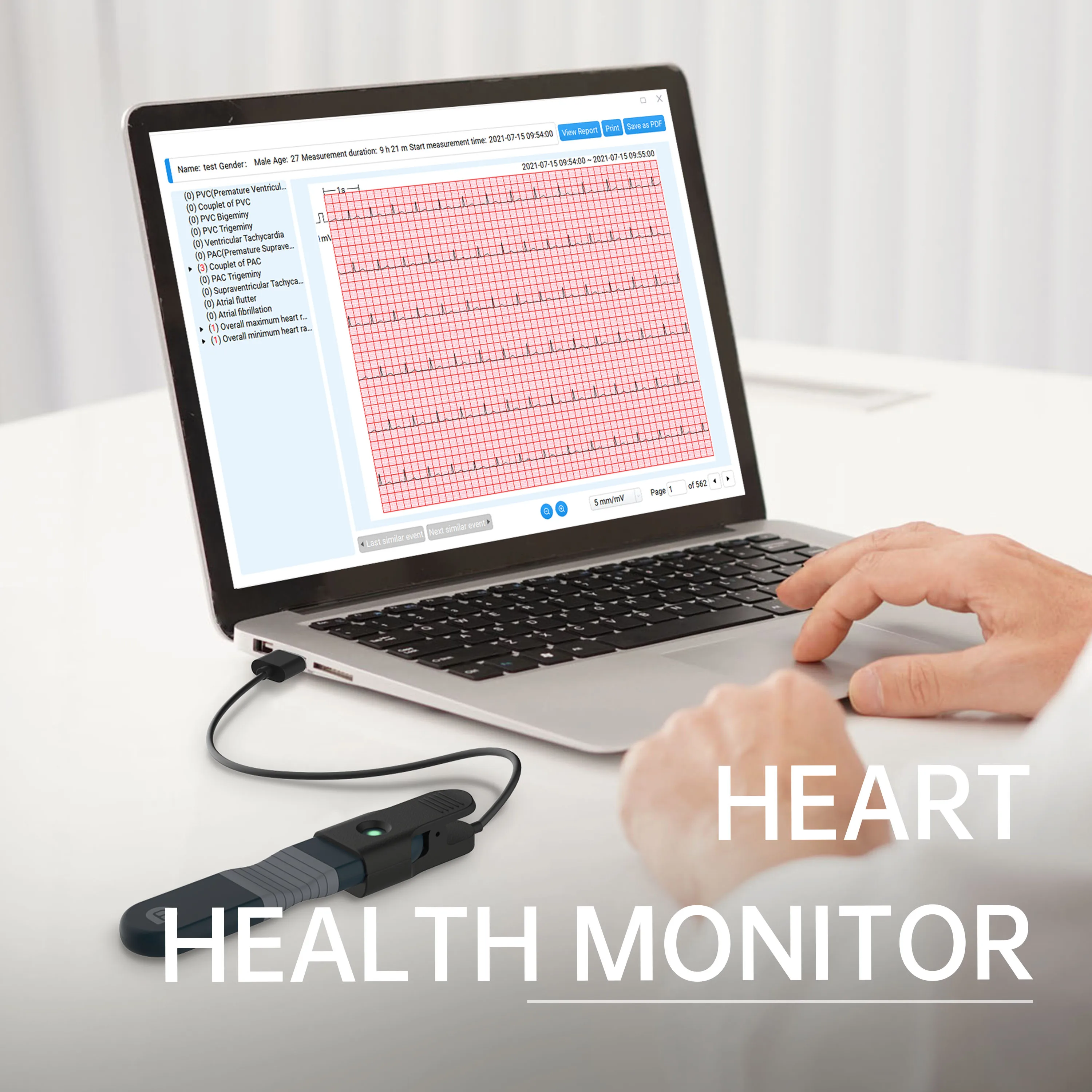 Wellue Er1 Monitor Ecg/Ecg Indossabile 24 Ore Su 24 Con Analisi Ai Monitoraggio Ecg In Tempo Reale Cardiofrequenzimetro Ecg Portatile Per Uso Domestic