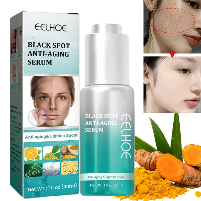 Kurkuma Fehérítő Szeplős Szérum Brighten Távolítsa El A Sötét Foltokat Melasma Megvilágít