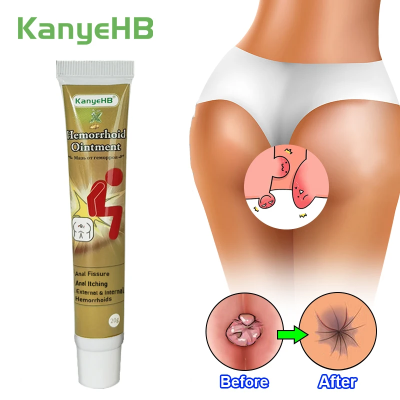 Relieve Pain Hemorrhoids Cream Anti Swelling Formula Anal Tear Bleeding Hemorrhoids Pain Relief Cream Repair Soft Tissue G003 pain relief cream knee pain relief cream