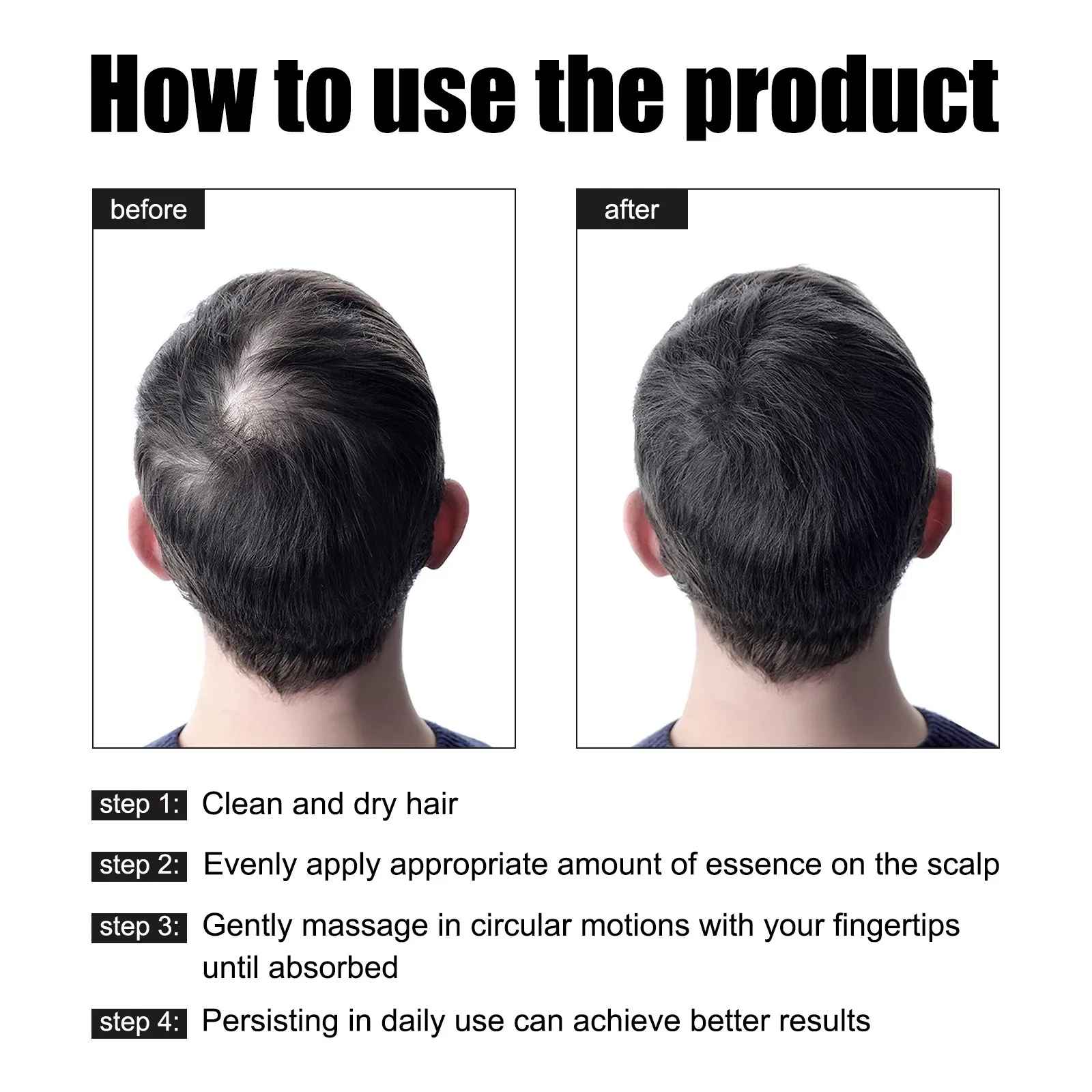 Hair Growth Liquid Nourishes Hair And Repairs Damaged Refreshing And Non Greasy Care Liquid 30ml