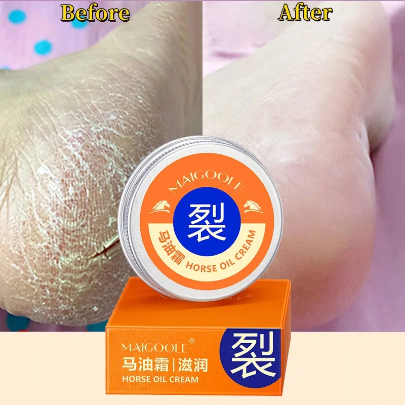 

Foot Fungus Removal Cream Relieve Foot Itching Remove Beriberi Dead Skin Foot Sweat Moisturize Repair Foot Cracked Ointment