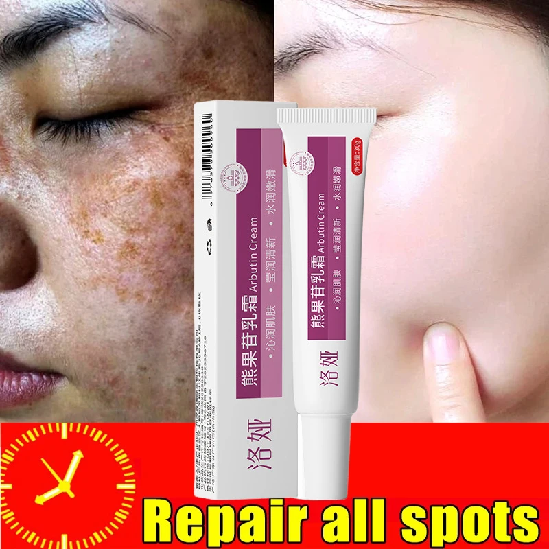 Facial Cream Freckle Whiten Cream Effective Removing Spot Eliminate Brown Stain Melasma Melanin Blemishes Lighten Moisturiser Face Skin Care