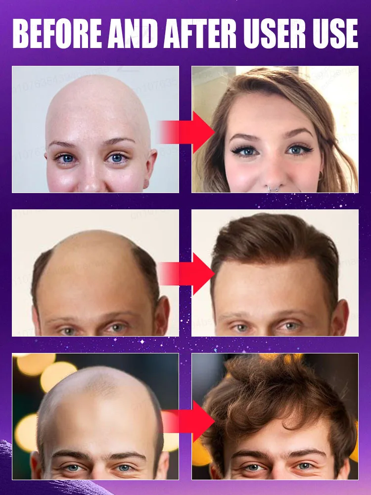 Designed specifically for those suffering from hair loss，No Add chemical stimulation