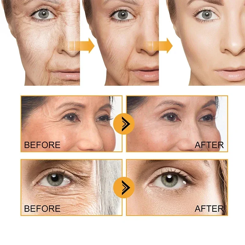 Facial Serum Facial Essence Retinol Face Serum Salicylic Acid Facial Serum Facial Anti Wrinkles Product Whitening Serum Instant Wrinkle Remover Face Serum Anti-Aging Lifting Firming Fade Fine Lines Improves Skin Dullness Moisturize Korean Cosmetics