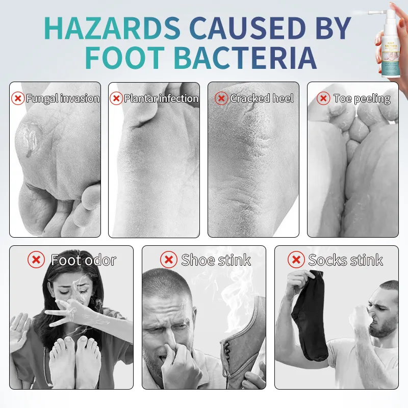 Рисунок 2 - Спрей от грибков для ног эффективно удаляет берибери